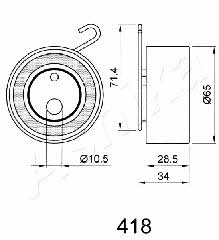 Ashika 45-04-418 Tensioner pulley, timing belt 4504418