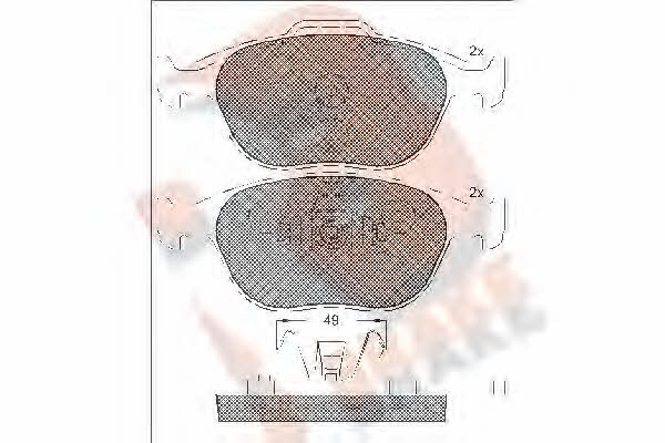 R Brake RB1537 Brake Pad Set, disc brake RB1537