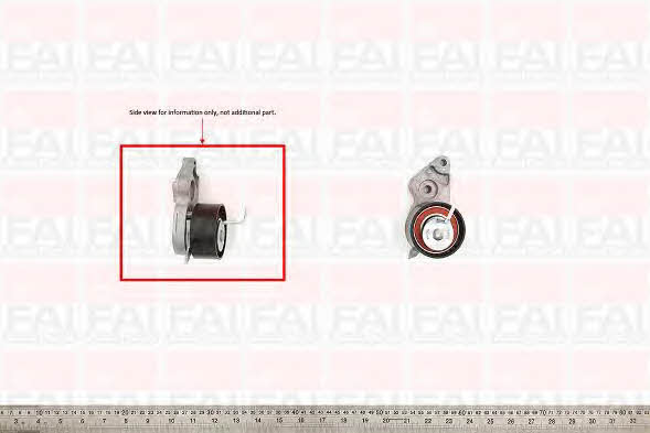 FAI T9315 Tensioner pulley, timing belt T9315