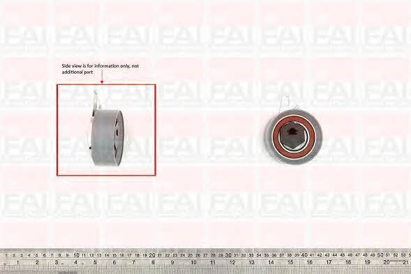 FAI T9486 Tensioner pulley, timing belt T9486