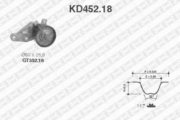 SNR KD45218 Timing Belt Kit KD45218