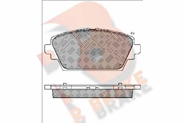 R Brake RB1581 Brake Pad Set, disc brake RB1581