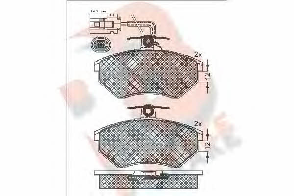 R Brake RB0996 Brake Pad Set, disc brake RB0996