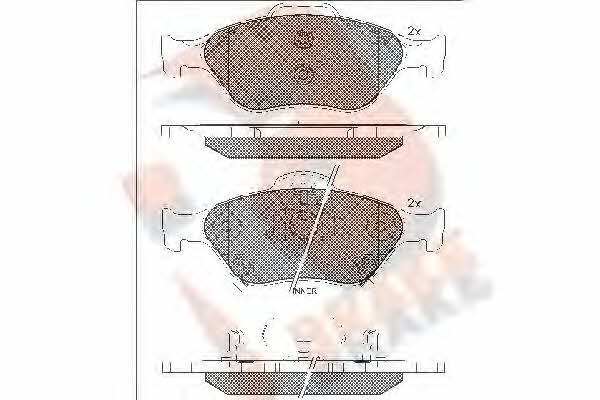 R Brake RB1877 Brake Pad Set, disc brake RB1877